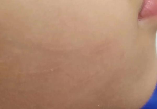 狗狗眼角膜上长小水泡 是什么病-警犬训练器材厂家 _警犬训练用品_工作犬训练用品-南京开久警犬装备