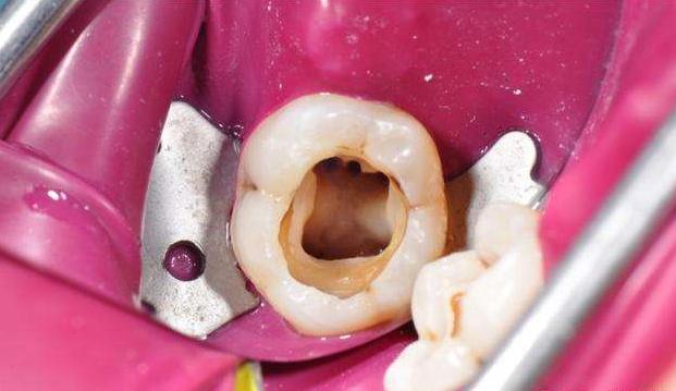 狗狗牙根炎症状 牙根炎的症状 - 警犬训练器材厂家 _警犬训练用品_工作犬训练用品-南京开久警犬装备-警犬训练器材厂家 _警犬训练用品_工作犬训练用品-南京开久警犬装备