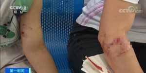 被狗瘟狗爪伤会不会得狂犬病萌宠-警犬训练器材厂家 _警犬训练用品_工作犬训练用品-南京开久警犬装备