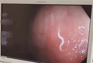 犬钩虫病的症状萌宠(犬钩虫病的症状怎么治疗)-警犬训练器材厂家 _警犬训练用品_工作犬训练用品-南京开久警犬装备