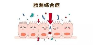 狗肠痉挛症状是什么(降结肠痉挛是什么症状)-警犬训练器材厂家 _警犬训练用品_工作犬训练用品-南京开久警犬装备