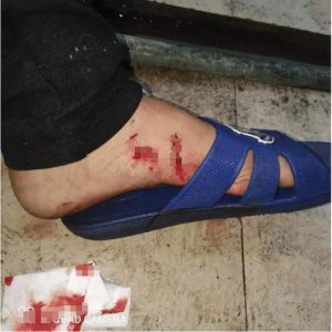 被狗狗咬了怎么办(狗狗被蚊子咬了怎么办)-警犬训练器材厂家 _警犬训练用品_工作犬训练用品-南京开久警犬装备