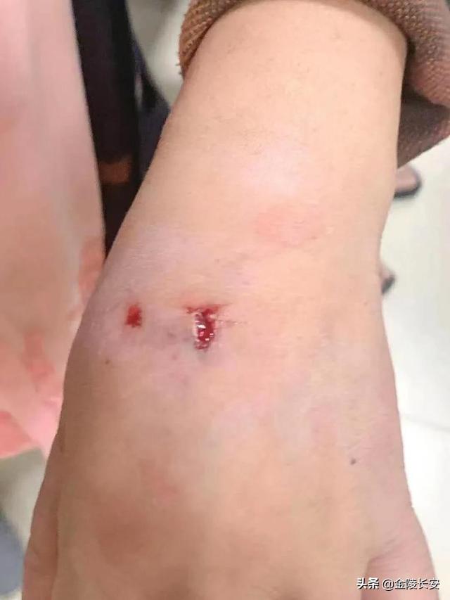 疯狗咬人(疯狗咬人后人会怎么样) - 警犬训练器材厂家 _警犬训练用品_工作犬训练用品-南京开久警犬装备-警犬训练器材厂家 _警犬训练用品_工作犬训练用品-南京开久警犬装备