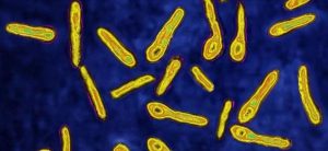 被狗狗咬了出血(狗狗被别的狗狗咬出血)-警犬训练器材厂家 _警犬训练用品_工作犬训练用品-南京开久警犬装备