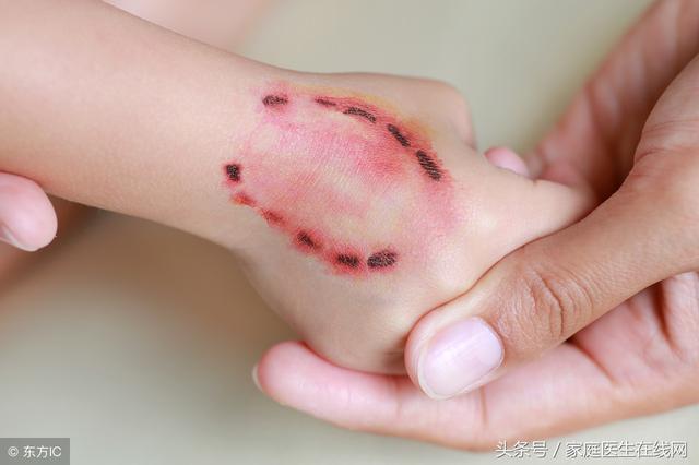 狂犬病早期症状狂(猫咪狂犬病的早期症状) - 警犬训练器材厂家 _警犬训练用品_工作犬训练用品-南京开久警犬装备-警犬训练器材厂家 _警犬训练用品_工作犬训练用品-南京开久警犬装备