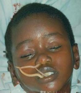 犬蛔虫症症状(有蛔虫的症状)-警犬训练器材厂家 _警犬训练用品_工作犬训练用品-南京开久警犬装备