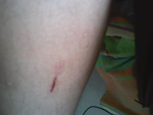 狗狗被咬了伤口发炎了怎么办(狗狗小桃子发炎了怎么办)-警犬训练器材厂家 _警犬训练用品_工作犬训练用品-南京开久警犬装备