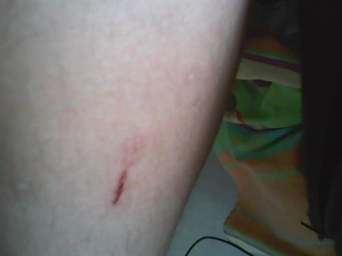 狗狗被咬了伤口发炎了怎么办(狗狗小桃子发炎了怎么办) - 警犬训练器材厂家 _警犬训练用品_工作犬训练用品-南京开久警犬装备-警犬训练器材厂家 _警犬训练用品_工作犬训练用品-南京开久警犬装备