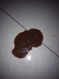 狗狗呕吐流鼻涕拉血(狗狗流鼻涕拉肚子呕吐是怎么回事)-警犬训练器材厂家 _警犬训练用品_工作犬训练用品-南京开久警犬装备