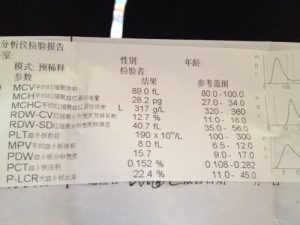 狗淋巴细胞百分比偏高(淋巴细胞百分比偏高是什么意思)-警犬训练器材厂家 _警犬训练用品_工作犬训练用品-南京开久警犬装备