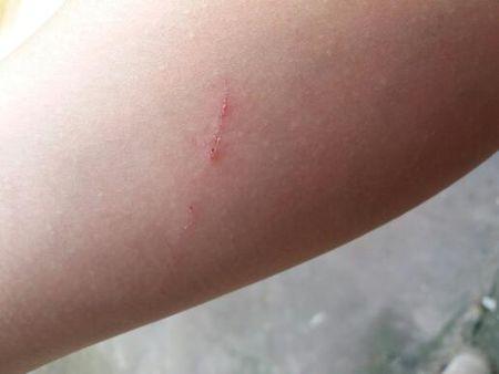 小狗爪子抓伤用打针吗(小狗爪子抓伤有血痕要打针么) - 警犬训练器材厂家 _警犬训练用品_工作犬训练用品-南京开久警犬装备-警犬训练器材厂家 _警犬训练用品_工作犬训练用品-南京开久警犬装备