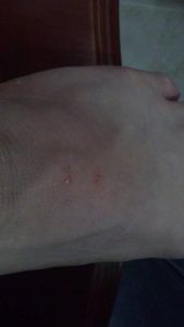 小狗被大狗咬了怎么处理(小狗被大狗咬了怎么处理会不会得狂犬病了)-警犬训练器材厂家 _警犬训练用品_工作犬训练用品-南京开久警犬装备