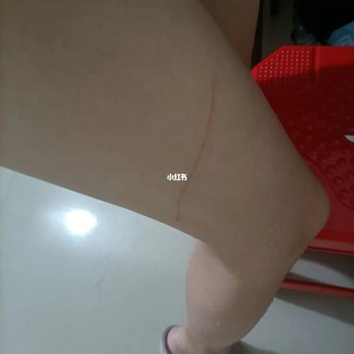 被宠物狗抓伤了严重吗 - 警犬训练器材厂家 _警犬训练用品_工作犬训练用品-南京开久警犬装备-警犬训练器材厂家 _警犬训练用品_工作犬训练用品-南京开久警犬装备