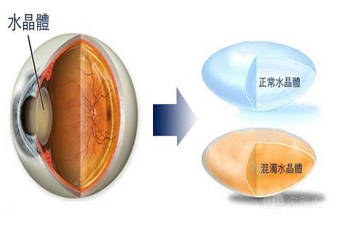 20221204234307_52151 20221204234307_52151